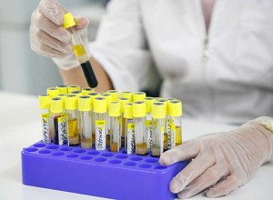 Лабораторные анализы как дополнительный метод обследования