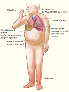 Общая симптоматика