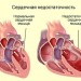 Сердечная недостаточность
