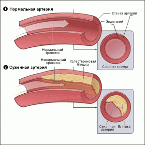 Причины заболевания