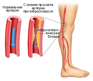 Общие сведения о заболевании