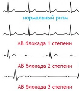Чем характеризуется недуг