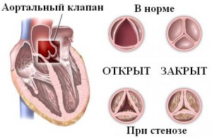 Особенности заболевания