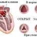 Особенности заболевания