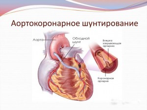 Варианты лечения