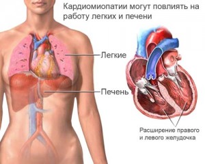Общие представления о заболевании