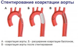 Хирургическое лечение патологии