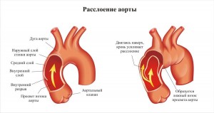 Особенности развития патологии