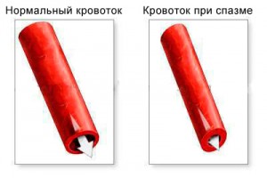 Почему развивается патология