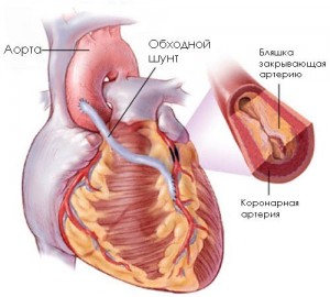 Хирургическое лечение