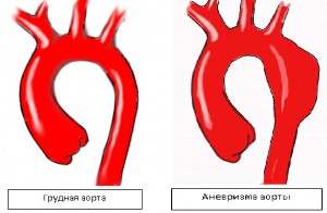 Как проявляется заболевание