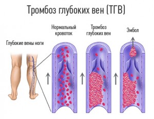 Причины развития болезни