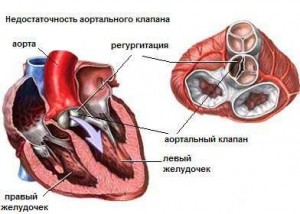 Причины развития порока