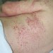 Разные виды болезни и их проявления