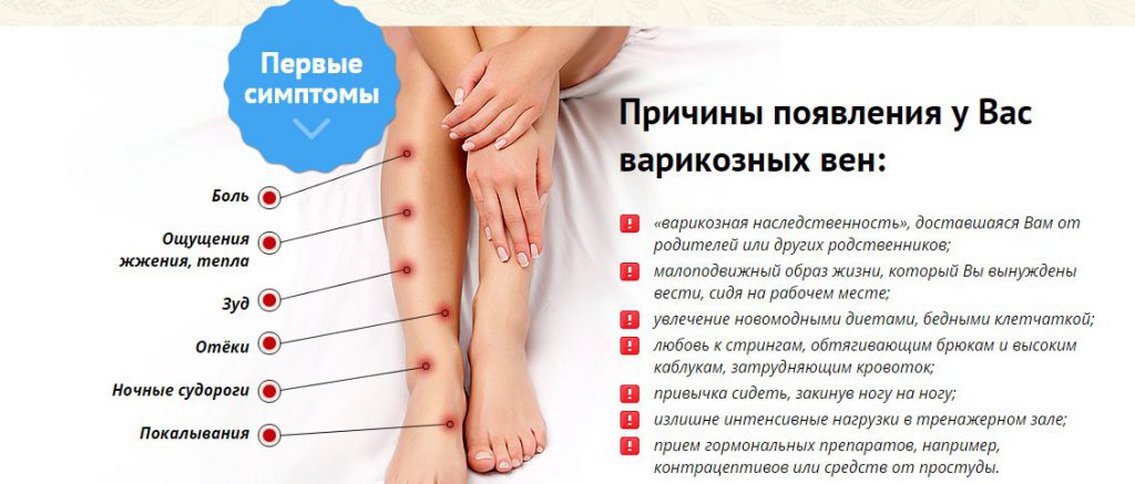 варикоз-лечение-народными-способами-1