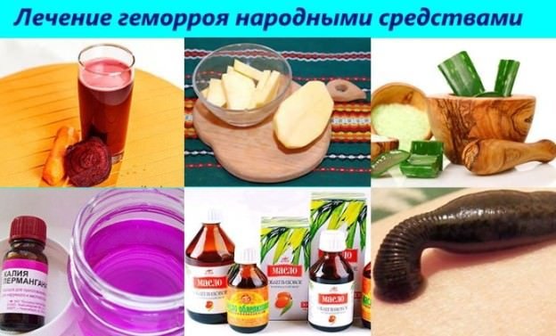 lechenie-gemorroya-narodnumi-sredstvami